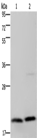 MCTS1 Polyclonal Antibody (E-AB-15193)