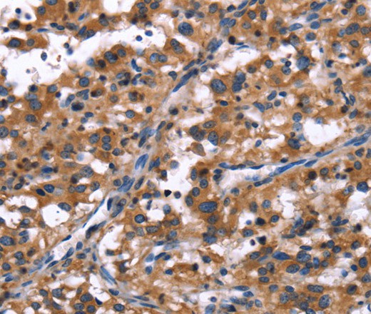 R3HCC1L Polyclonal Antibody (E-AB-16455)