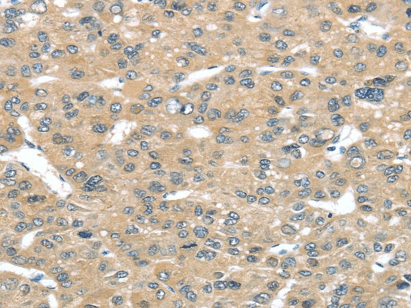 TUSC2 Polyclonal Antibody (E-AB-17174)