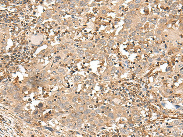 FSTL5 Polyclonal Antibody (E-AB-17977)