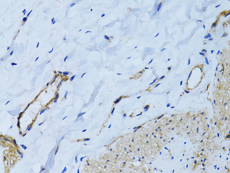 MCAM Polyclonal Antibody (E-AB-64865)