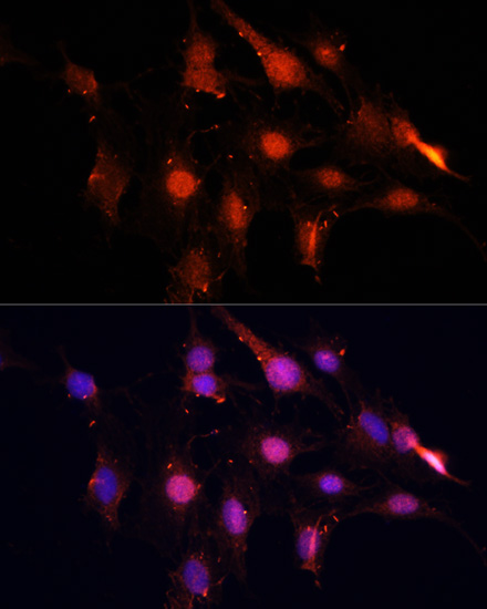 NSUN2 Polyclonal Antibody (E-AB-65440)