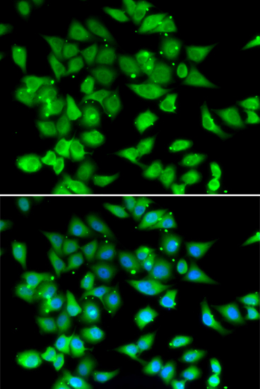 NFATC3 Polyclonal Antibody (E-AB-61285)