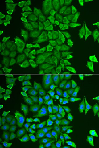 APEH Polyclonal Antibody (E-AB-64657)