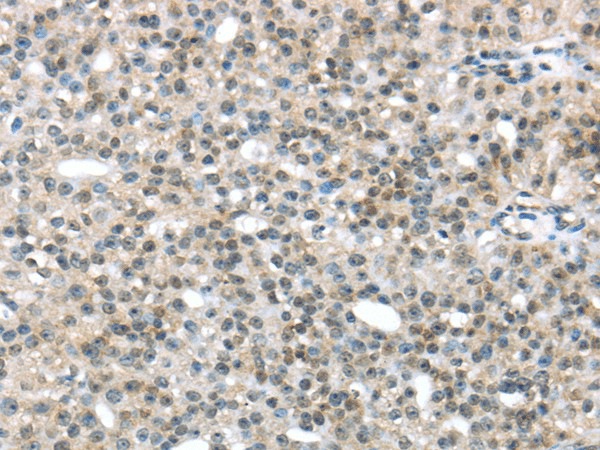 TRIP6 Polyclonal Antibody (E-AB-17157)