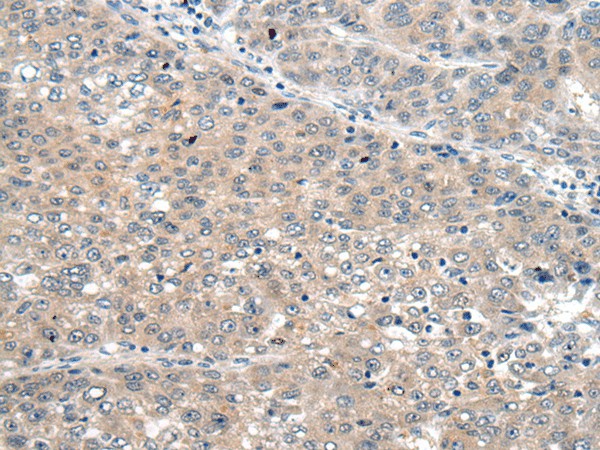 SEMA4D Polyclonal Antibody (E-AB-52208)