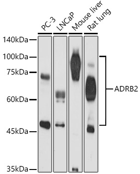 ADRB2 Polyclonal Antibody (E-AB-92258)