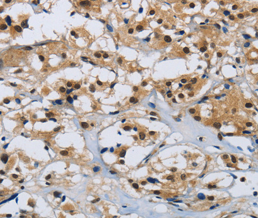 CMTM8 Polyclonal Antibody (E-AB-12451)