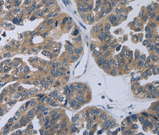 TP53AIP1 Polyclonal Antibody (E-AB-16678)