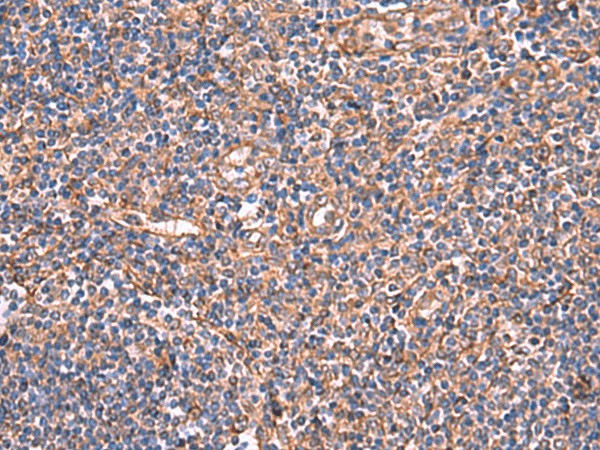 TTC38 Polyclonal Antibody (E-AB-19056)