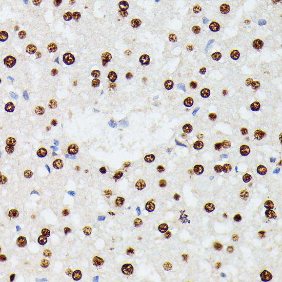 HNRNPD Polyclonal Antibody (E-AB-66532)