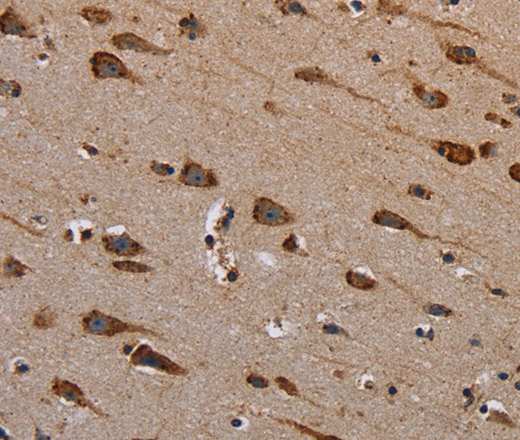 PLXNB1 Polyclonal Antibody (E-AB-13523)
