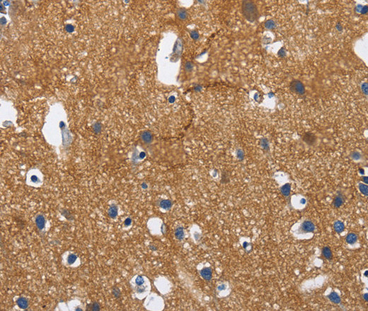 CADM3 Polyclonal Antibody (E-AB-14811)