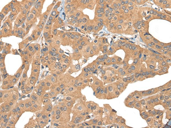 PPP3R1 Polyclonal Antibody (E-AB-18581)