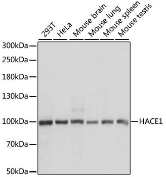 HACE1 Polyclonal Antibody (E-AB-65634)