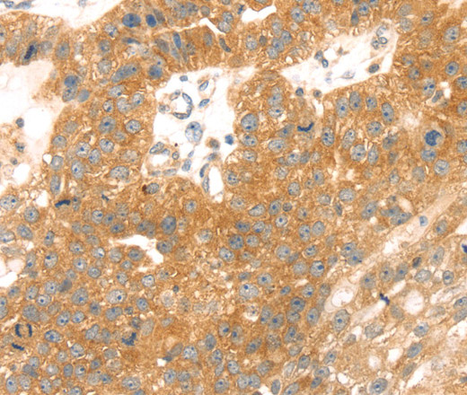 TMEFF2 Polyclonal Antibody (E-AB-13737)