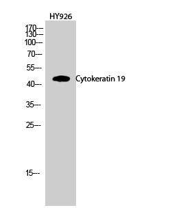 CK-19 Polyclonal Antibody (E-AB-31146)