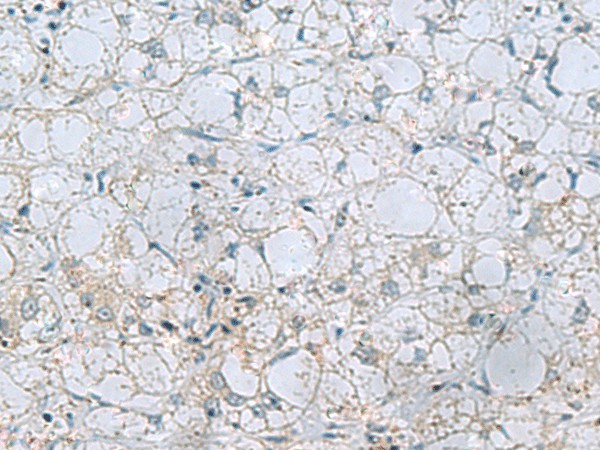 NAGK Polyclonal Antibody (E-AB-53155)