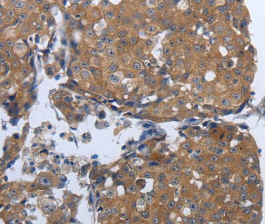 PDIA2 Polyclonal Antibody (E-AB-12840)