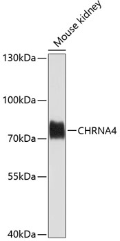 CHRNA4 Polyclonal Antibody (E-AB-62040)
