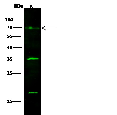 GOLM1/GP73 Monoclonal Antibody (AN200222P)