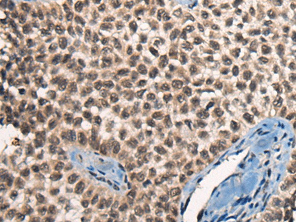 CITED2 Polyclonal Antibody (E-AB-17803)
