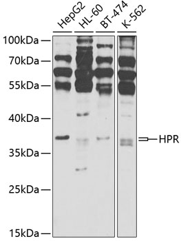 HPR Polyclonal Antibody (E-AB-68034)