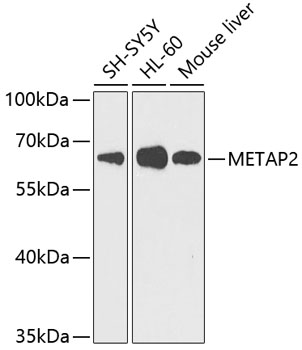 METAP2 Polyclonal Antibody (E-AB-62370)