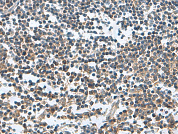 FAM107B Polyclonal Antibody (E-AB-19116)