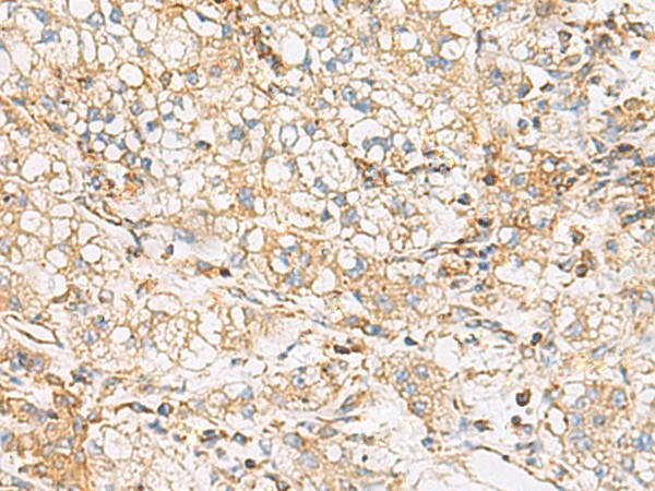 FYCO1 Polyclonal Antibody (E-AB-53120)