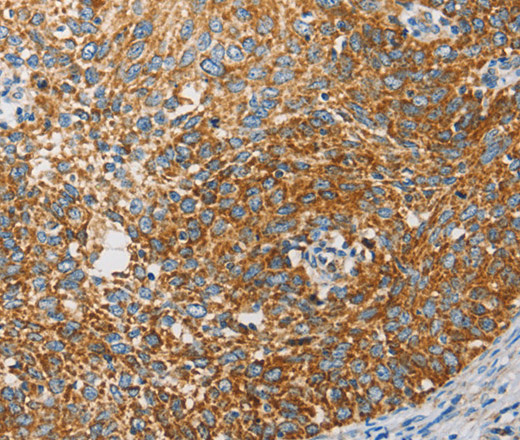 APOBEC3G Polyclonal Antibody (E-AB-10817)