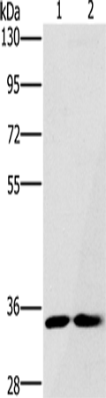 FAIM2 Polyclonal Antibody (E-AB-15010)