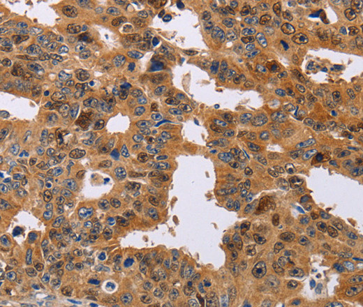 NIF3L1 Polyclonal Antibody (E-AB-10783)
