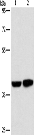 CAB39L Polyclonal Antibody (E-AB-14809)