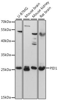 PID1 Polyclonal Antibody (E-AB-90611)