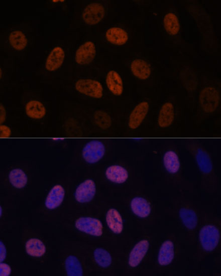 WDHD1 Polyclonal Antibody (E-AB-65301)