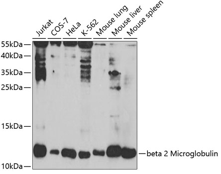 beta 2 Microglobulin Polyclonal Antibody (E-AB-66504)