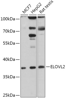 ELOVL2 Polyclonal Antibody (E-AB-91880)