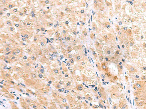 ITGA3 Polyclonal Antibody (E-AB-18119)