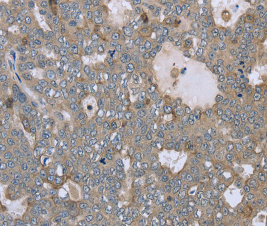 FAR2 Polyclonal Antibody (E-AB-11219)