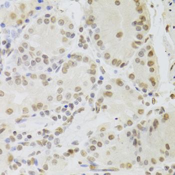 RUVBL1 Polyclonal Antibody (E-AB-61084)