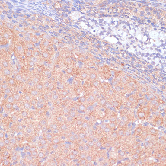 KANK2 Polyclonal Antibody (E-AB-66482)