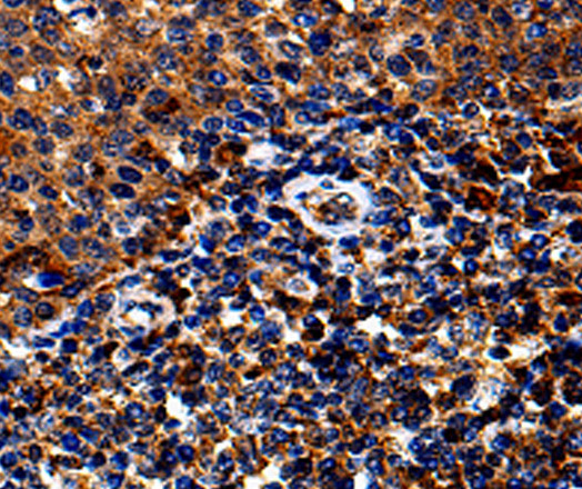 IL13RA1 Polyclonal Antibody (E-AB-10102)