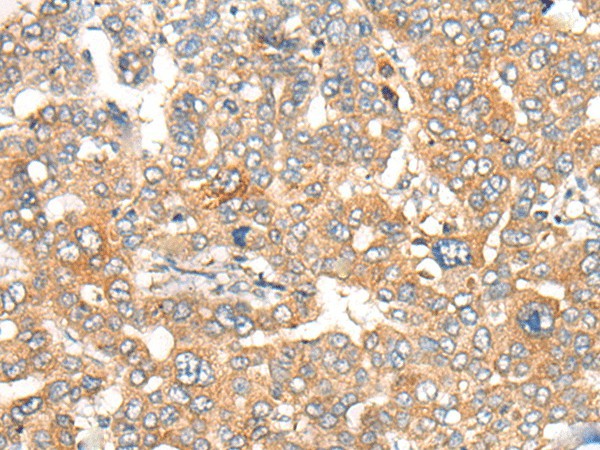 CASP4 Polyclonal Antibody (E-AB-53537)