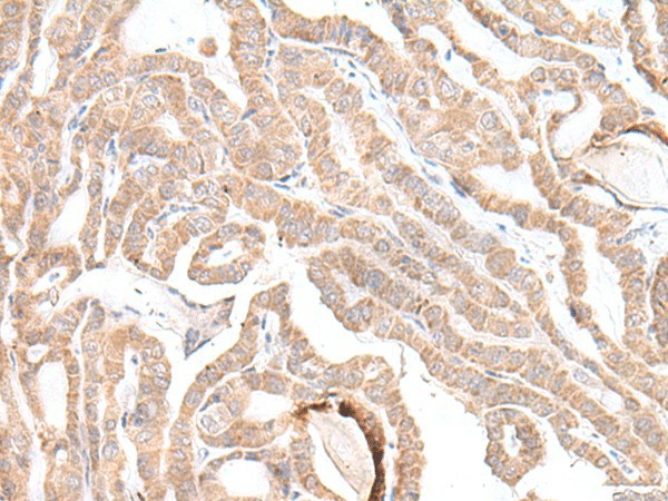PLGLB2 Polyclonal Antibody (E-AB-52674)
