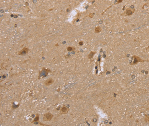 DLD Polyclonal Antibody (E-AB-14947)