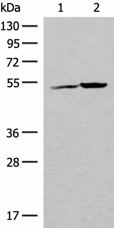 FECH Polyclonal Antibody (E-AB-19863)