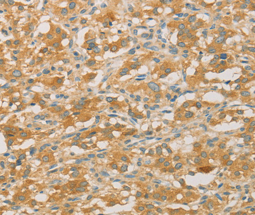 PRPSAP1 Polyclonal Antibody (E-AB-14676)