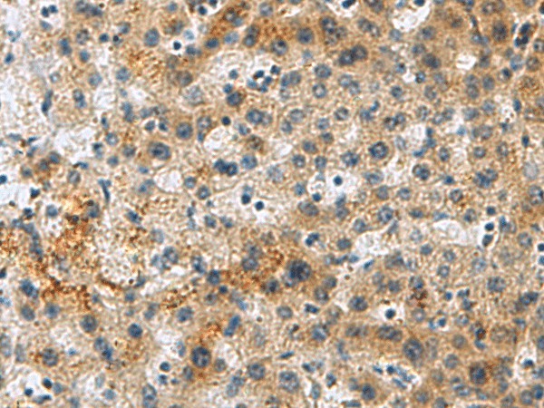PLIN4 Polyclonal Antibody (E-AB-18190)
