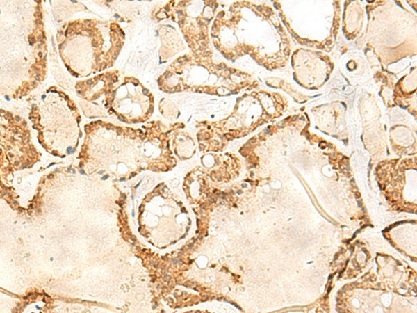 JPT1 Polyclonal Antibody (E-AB-52818)
